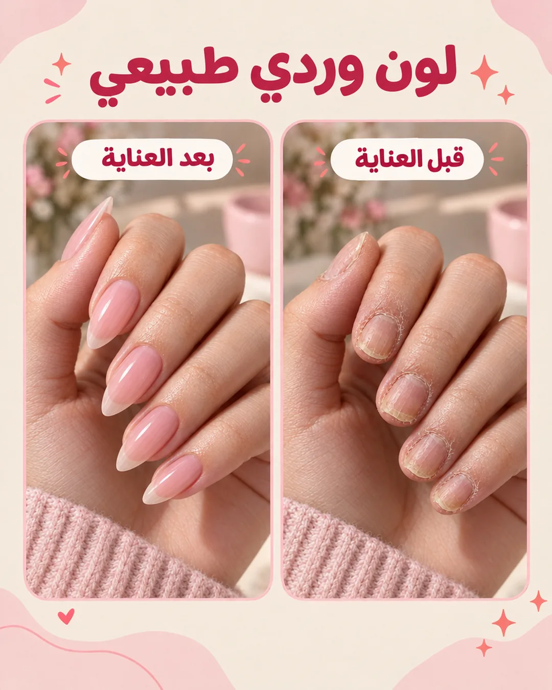 لون وردي طبيعي — مقارنة الأظافر قبل العناية وبعدها